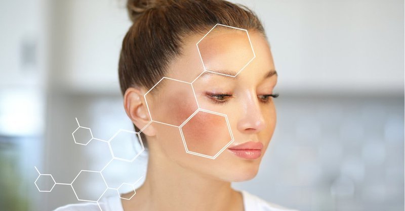Điều trị tàn nhang hiệu quả tại Svietspa